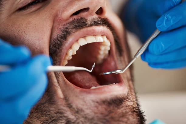 Dental X-Rays and Imaging in Taylor, AZ